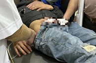 Nam thanh niên ở Quảng Bình nghi tự lấy kéo cắt 'chỗ hiểm' đứt gãy