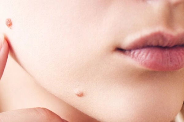 4 bệnh tình dục gây ra hơn 1 triệu ca mắc mới mỗi ngày-2