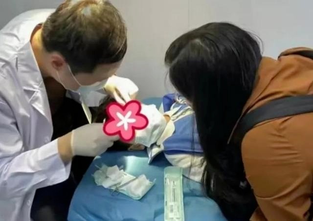 Bé 3 tuổi bị dính keo 502 vào mắt, mẹ làm ngay 2 thao tác cứu được đôi mắt con-1