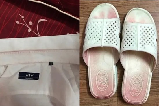 Quần áo, dép nhuộm đỏ vì bệnh 'mồ hôi máu' chỉ 2 người Việt mắc