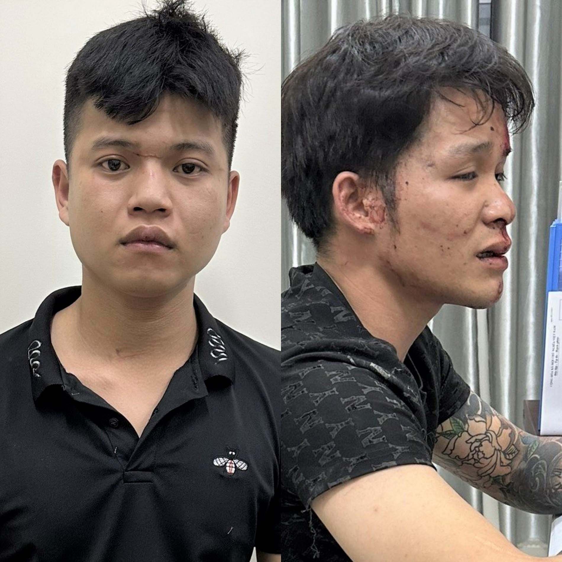 Ném đá vào cảnh sát 911, 2 thanh niên Đà Nẵng bị bắt-1