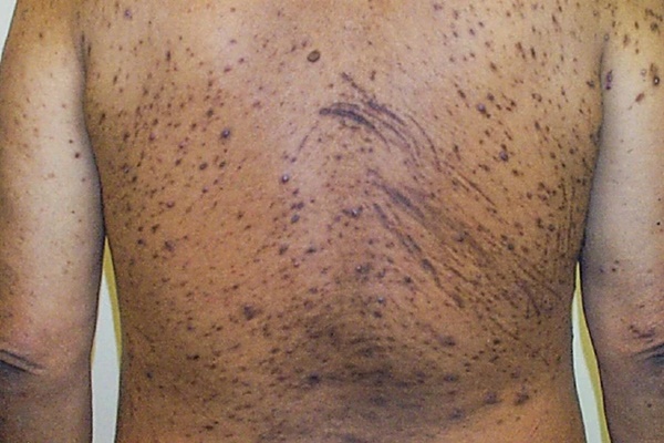 Dấu hiệu thận đang kêu cứu, người trẻ cần đặc biệt chú ý điểm này-2