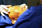 Nữ Việt kiều tử vong khi làm đẹp: Do ngộ độc thuốc tê?-2
