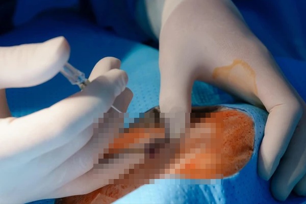 Ăn kẹo không rõ nguồn gốc trước cổng trường, 15 học sinh ở Quảng Ngãi bị ngộ độc-2