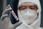 Thêm nghi vấn virus Covid-19 rò rỉ từ phòng thí nghiệm