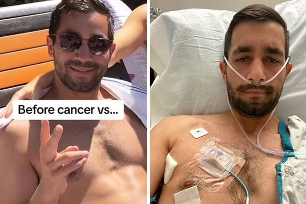 Người đàn ông 29 tuổi mắc ung thư di căn khắp cơ thể, phải làm hơn 11 cuộc phẫu thuật vì món ăn nhiều người yêu thích-1
