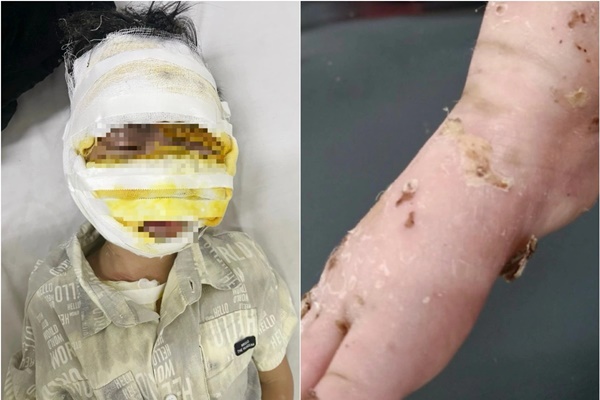 Clip: Ném tàn thuốc lá xuống cống, 2 người đàn ông tử vong sau vụ nổ-1