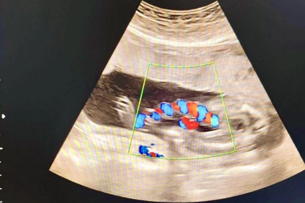 Đoạn chat vợ mượn tiền chồng để đi tiêm cho con cay đắng nhất lúc này: Không tiền, tất cả màu hồng cũng thành màu nước mắt!-3