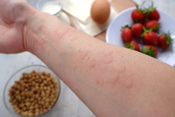 Dừng ăn cà rốt ngay nếu xuất hiện triệu chứng này-2