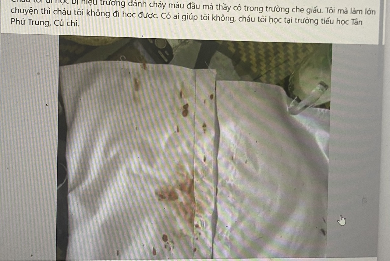 TP HCM: Xác minh sự việc hiệu trưởng đánh học sinh chảy máu-1