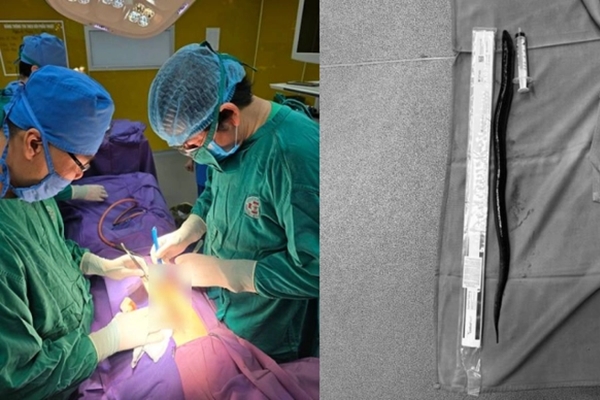 Hoại tử da thịt trong một ngày vì đi chân trần lội nước-3