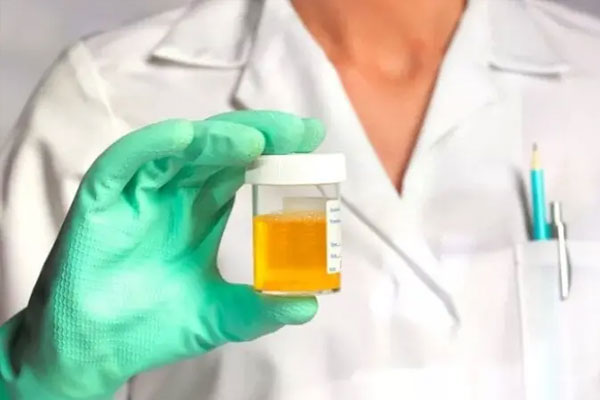 Nước tiểu ra bọt như bọt bia có phải bị bệnh thận?-1