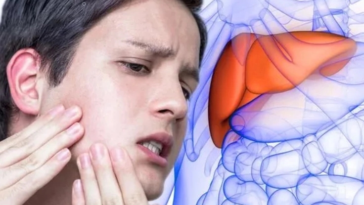 6 bộ phận trên cơ thể sưng tấy bất thường cảnh báo tổn thương gan nghiêm trọng-3