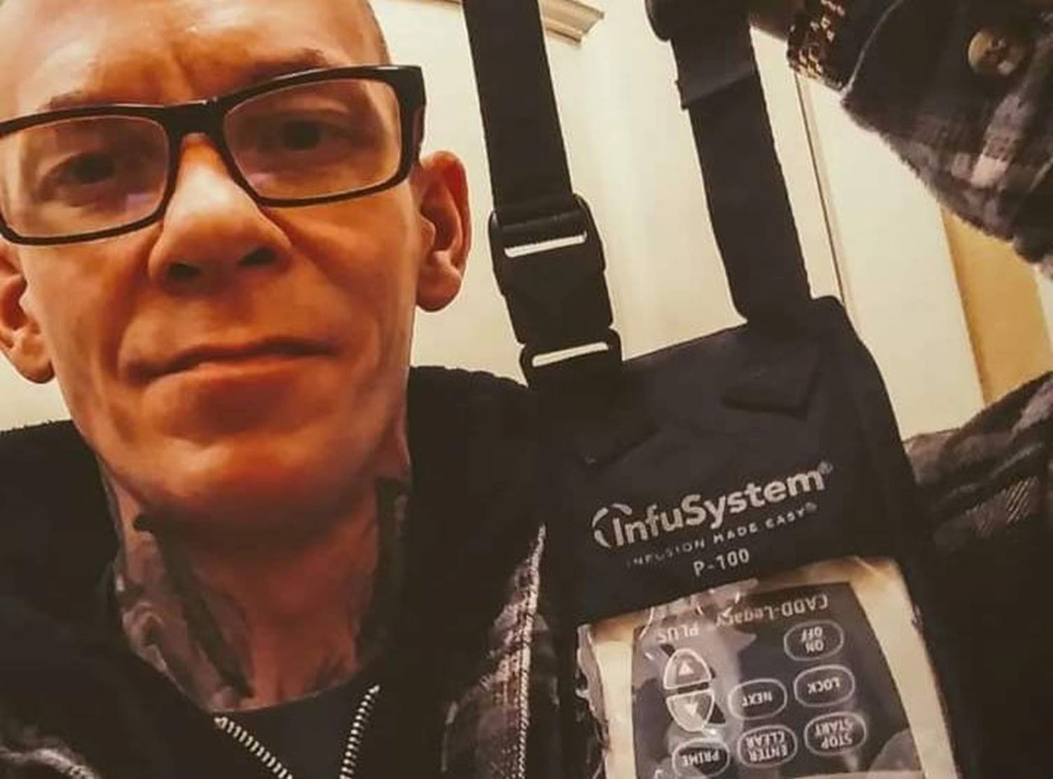 Trì hoãn làm 1 việc, người đàn ông hối hận cùng cực khi phát hiện mắc ung thư giai đoạn 3-2