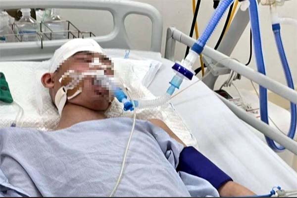 Vụ nam sinh lớp 8 bị đánh chết não ở Hà Nội: Luật sư nhận định vai trò của người bố trong sự việc-2