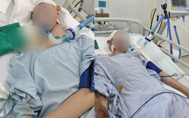 Gia cảnh xót xa của nam sinh lớp 8 bị đánh chết não: Bố mất sớm, chỉ còn hai mẹ con khó khăn nương tựa nhau-2