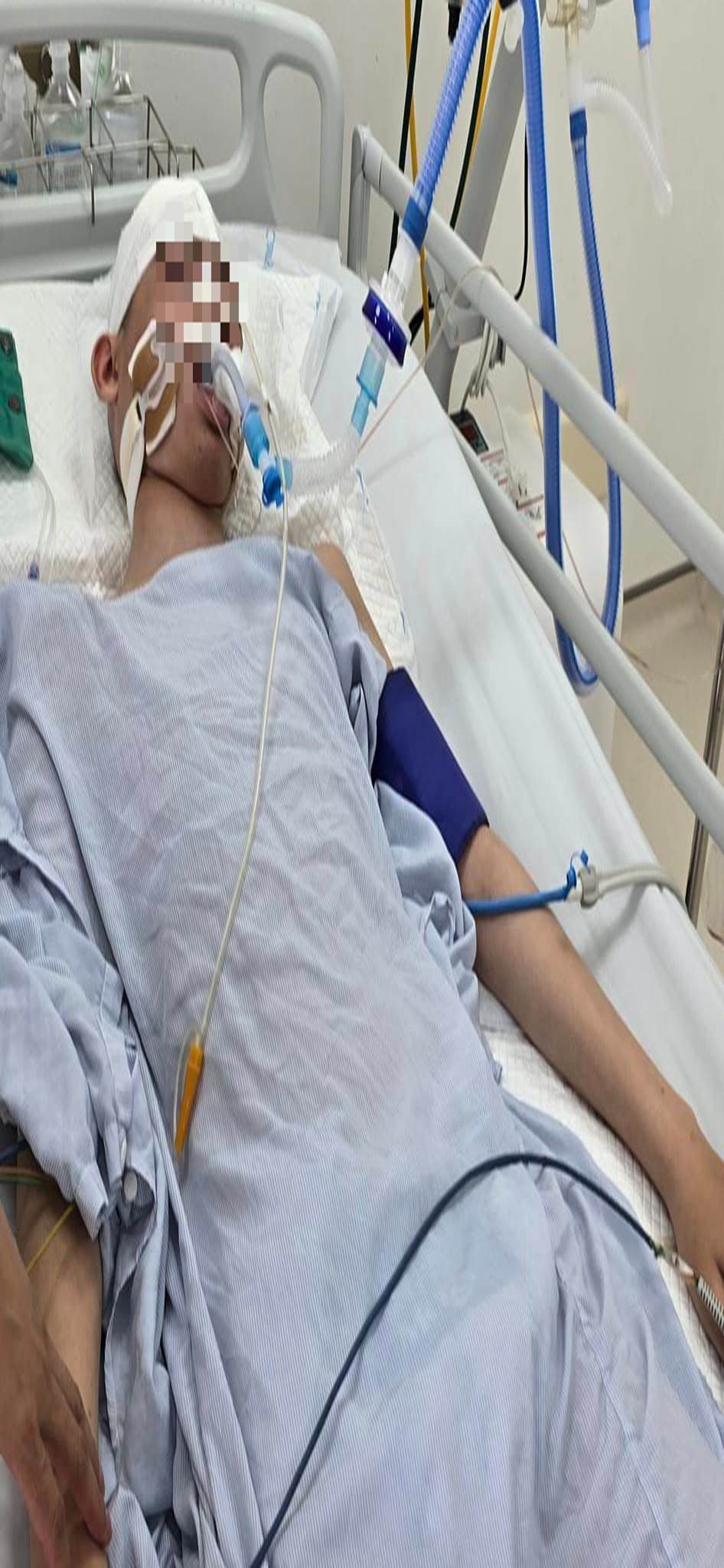 Bé trai lớp 8 bị đánh đến chết não tại Hà Nội: Có thể khởi tố vụ án giết người?-1