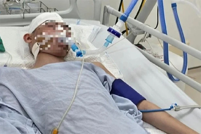 Nam sinh lớp 8 bị đánh đến chết não khi chơi bóng rổ: Cục Trẻ em lên tiếng-2