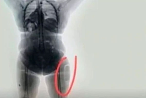 Nữ nhân viên an ninh sân bay phát hiện hành khách đi khập khiễng, phanh phui cả 1 đường dây buôn lậu hơn 100 tỷ đồng-2