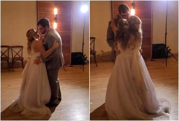 Cặp song sinh dính liền nổi tiếng nhất thế giới: Dùng chung một cơ thể suốt 34 năm, cuộc sống hiện tại gây kinh ngạc-2