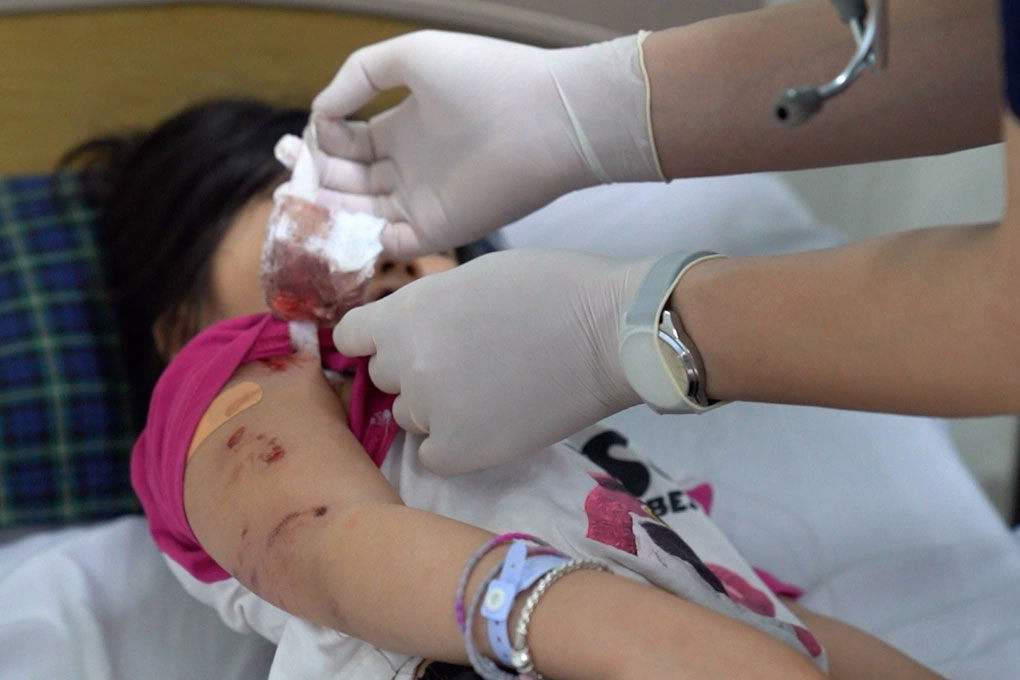 Bé gái bị chó dữ cắn tới tấp trong 1 phút, xét nghiệm chó nghi mắc bệnh dại-2