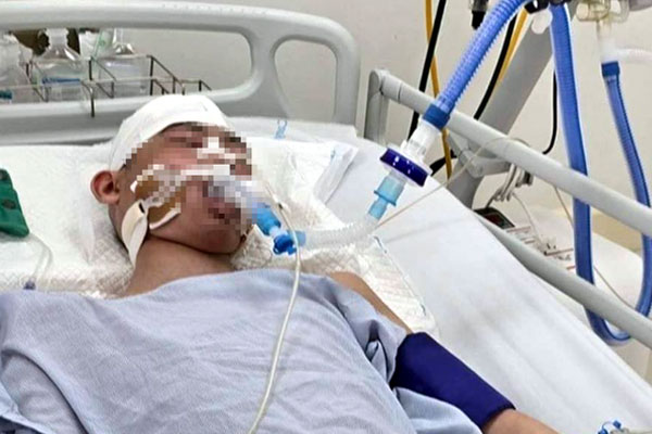 Nam sinh lớp 8 bị đánh chấn thương sọ não: Có phản xạ nhẹ, chưa rõ tiên lượng-1