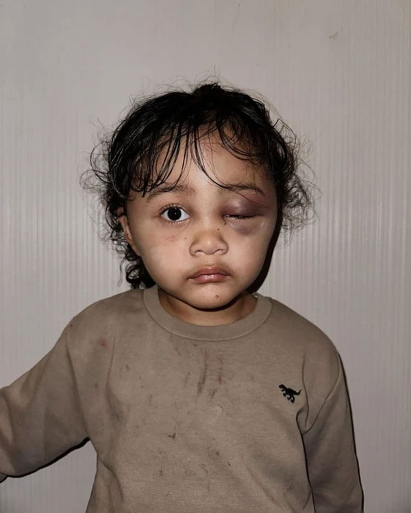 Hành hạ dã man bé gái, bảo mẫu bị bố mẹ nạn nhân hỏi tội liền có biểu hiện khó đỡ: Hút 3 triệu lượt xem-1