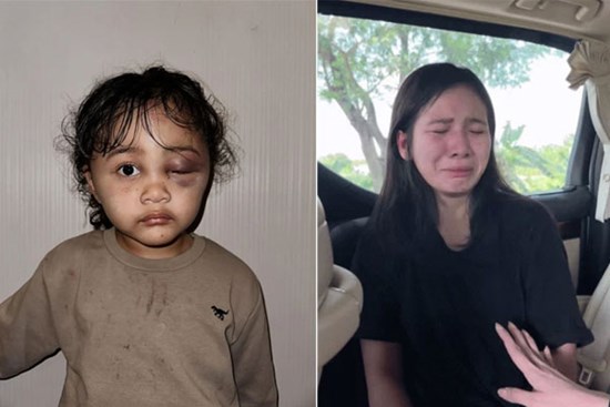 Hành hạ dã man bé gái, bảo mẫu bị bố mẹ nạn nhân hỏi tội liền có biểu hiện khó đỡ: Hút 3 triệu lượt xem
