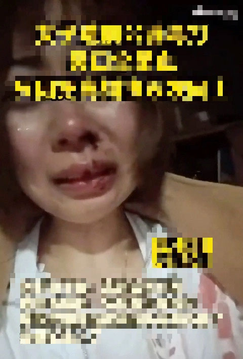 Con dâu bị bố mẹ chồng cũ đánh tơi tả vì dám đăng đơn ly hôn lên mạng để công khai chuyện mình đã độc thân-1