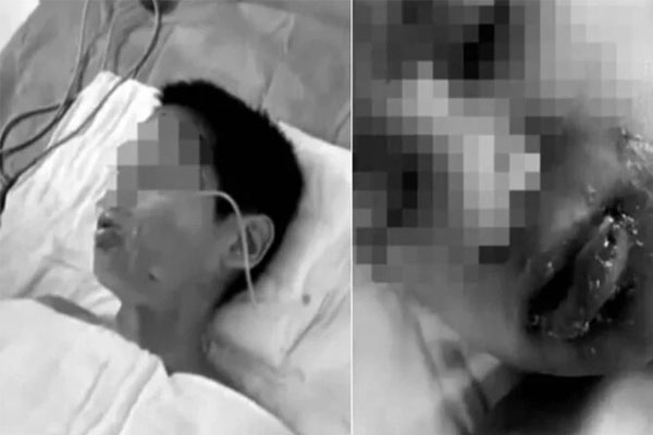 Ép bạn uống nước sôi, vụ bạo lực học đường khiến dân mạng Trung Quốc sôi sục-1