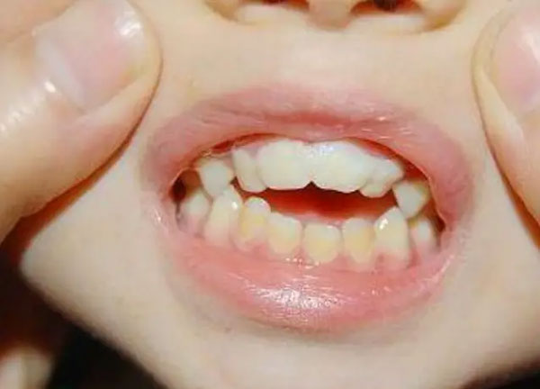 Cậu bé 3 tuổi mở miệng khiến bố mẹ phát hoảng, hỏi tại sao thì tất cả do ông bà gây ra-2