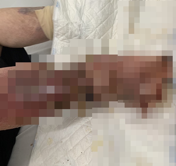 1 thói quen bức tử cơ quan nắm giữ sinh mệnh của cơ thể: Rất nhiều người Việt hồn nhiên làm mỗi ngày-1