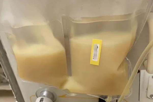 Chàng trai 30 tuổi máu trắng sệt như sữa đặc, món ăn yêu thích của nhiều người là thủ phạm-1