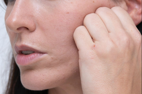 Da nhăn nheo, chảy xệ dù còn trẻ: nguyên nhân do đâu?-1