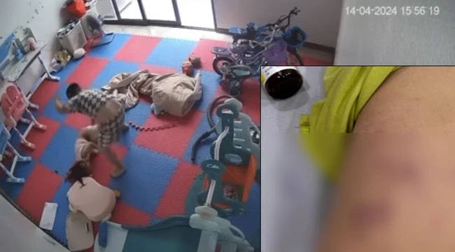 Xôn xao clip bé gái bị đứa trẻ 6 tuổi nhà hàng xóm đánh tím người, nhiều phụ huynh bàng hoàng, thắc mắc về cách giáo dục con-1