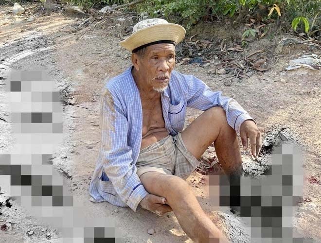 Điều tra vụ cụ ông 85 tuổi bị dập nát 2 bàn chân-1
