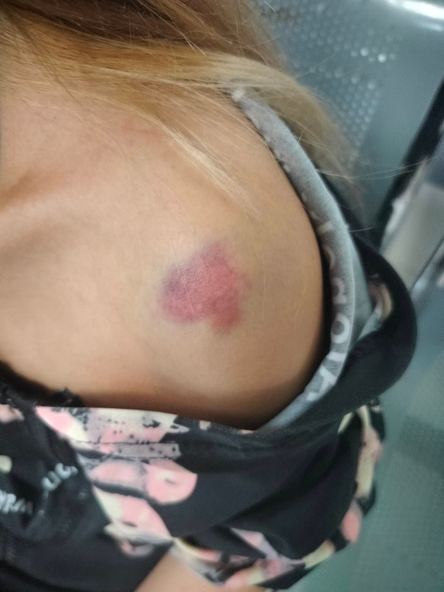 Bị chồng bạo hành dã man, vợ gọi cho người yêu cũ để cầu cứu và cái kết bất ngờ gây xôn xao dư luận-3