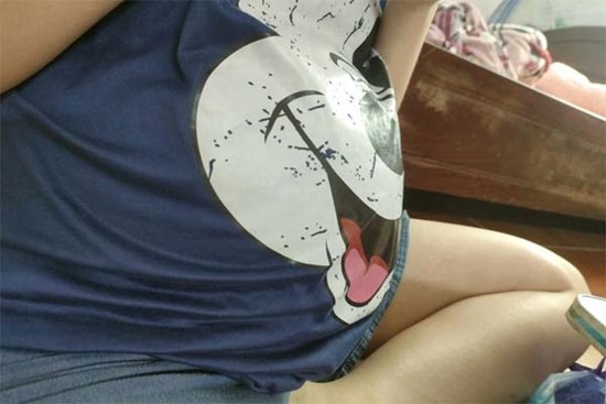 Vụ bé 12 tuổi mang thai ở Hà Nội: Dự kiến sẽ mổ đẻ vào chiều nay