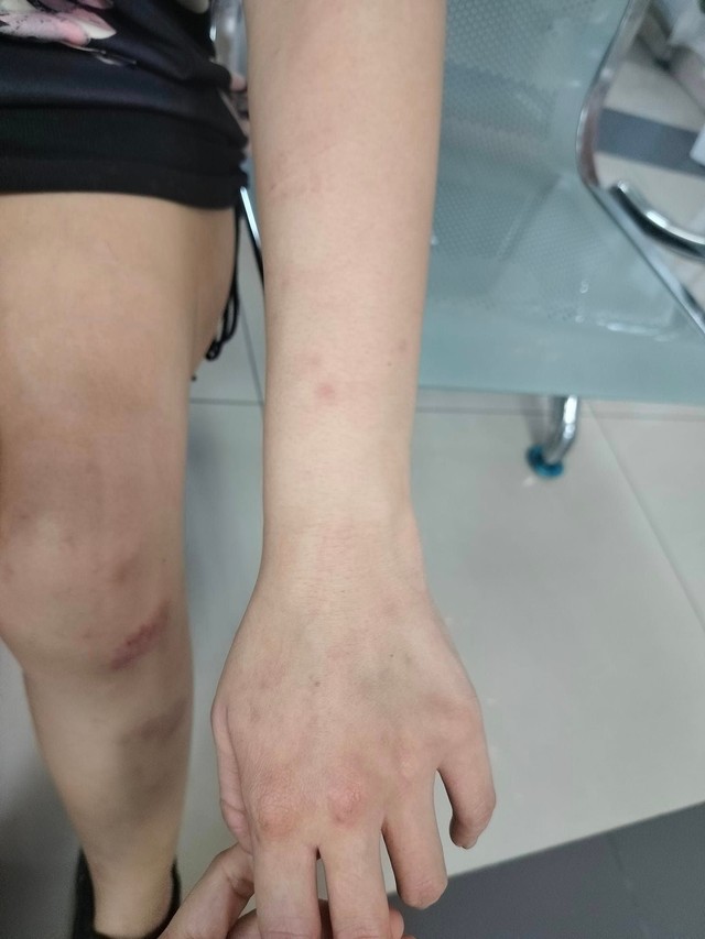 Bị chồng bạo hành dã man, vợ gọi cho người yêu cũ để cầu cứu và cái kết bất ngờ gây xôn xao dư luận-2