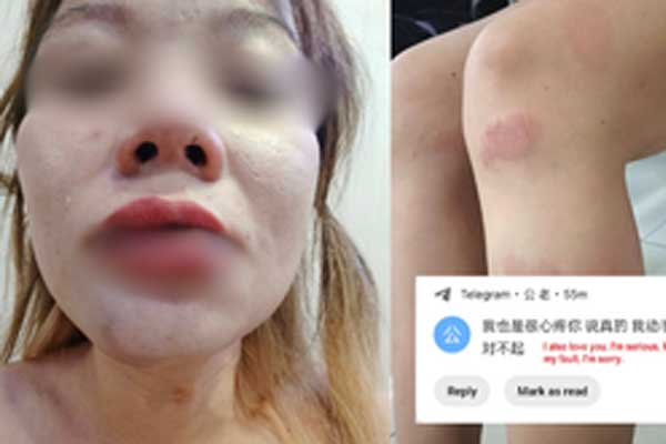 Vợ dội ấm nước sôi vào đầu chồng vì mâu thuẫn: Cư dân mạng quay xe sau khi chứng kiến cảnh trước đó-3