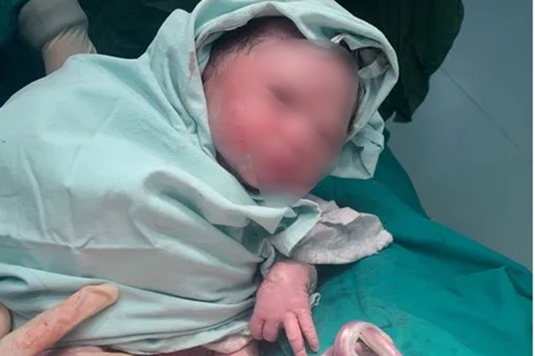 Dây rốn quấn quanh người bé gái khi chào đời-2
