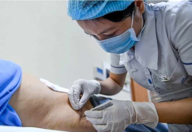 Bụng và rốn bị hoại tử nghiêm trọng sau khi hút mỡ ở spa-1