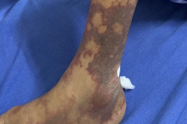 Sau 3 ngày nhậu với món vạn người mê, người đàn ông đi cấp cứu-1