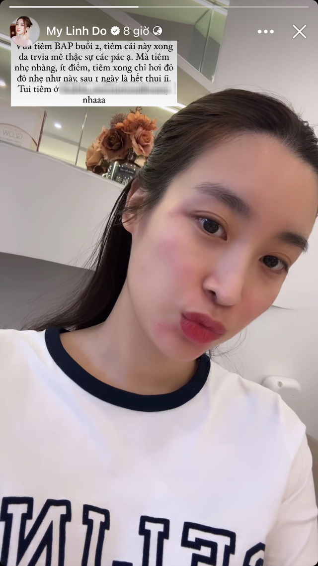 Chủ tịch CLB Hà Nội ở đâu giữa lúc hoa hậu Đỗ Mỹ Linh tiêm thẩm mỹ?-2