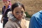 Vụ bé lớp 1 ở Yên Bái bị đánh tím mắt: Thông tin bất ngờ về cô giáo-3