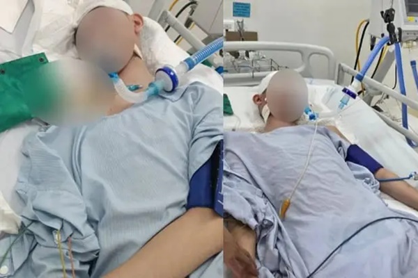Tình hình nam sinh lớp 8 bị bạn học đánh chấn thương sọ não nguy kịch hiện tại ra sao?-1
