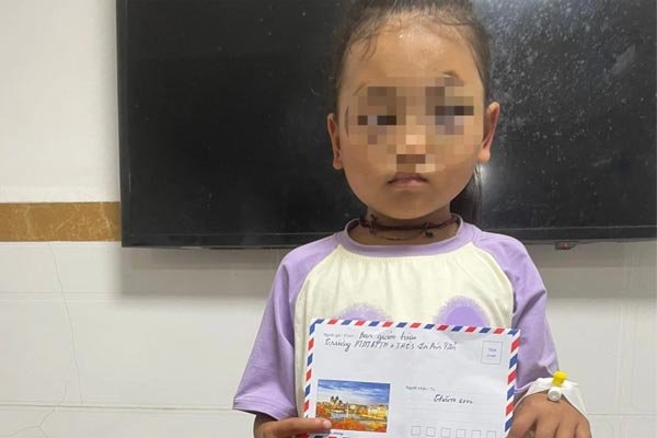 Hình ảnh nam sinh mặt lấm lem, trầy xước gây xôn xao dư luận-3