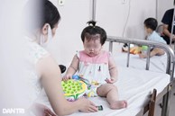 Tay chân miệng tại Hà Nội vào đỉnh dịch: Triệu chứng nguy hiểm nhất
