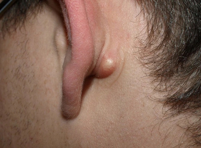 Nam thanh niên độ tuổi 20 qua đời vì ung thư sau khi xem nhẹ 2 cảm giác khó chịu vào ban đêm-2