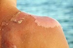 5 kinh nghiệm chăm sóc da mùa hè, đảm bảo làn da căng bóng ngậm nước và tươi trẻ dài lâu-2